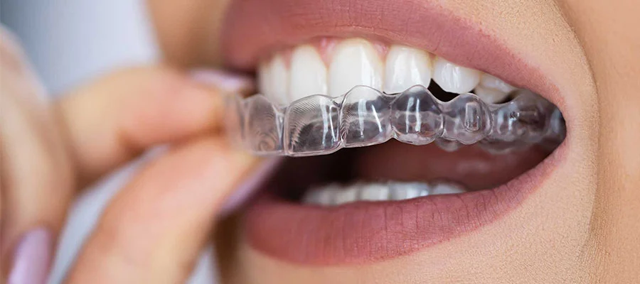 Invisalign